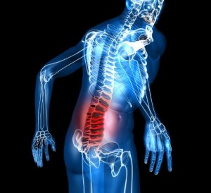 backache1