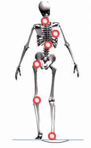 bad posture posturepro