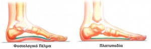 platipodia