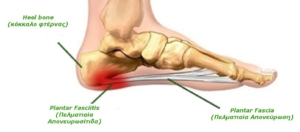 plantar graph2